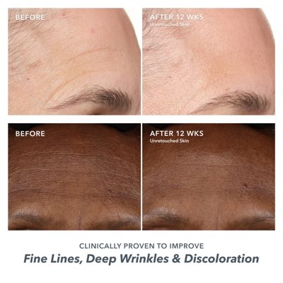 + Free Mini Milk RX Cream Milk RX Trio: 3-Step Better Aging Routine