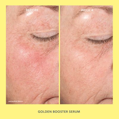 Golden Booster Vitamin C Brightening Serum