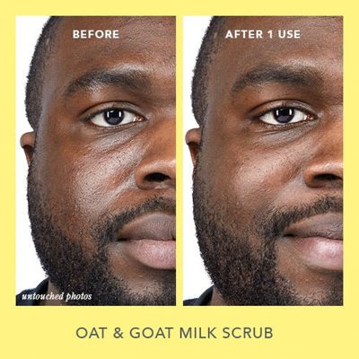 Scrub & Glow Skincare Set